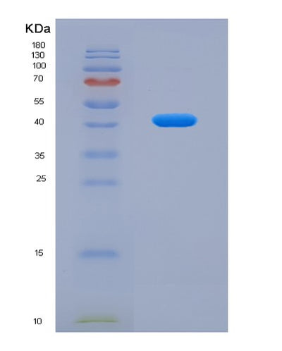 SDS-PAGE analysis of Human CD19 (B-Lymphocyte Antigen Cd19) - Recombinant Protein, CAT# BLT-07927P, showing >90% purity under 15% SDS-PAGE (Reduced)Human CD19 (B-Lymphocyte Antigen Cd19) - Recombinant Protein