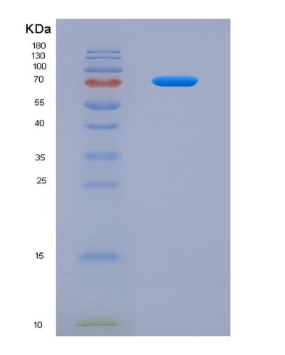 SDS-PAGE analysis of Human SMPD1 (Sphingomyelin Phosphodiesterase) - Recombinant Protein, CAT# BLT-07929P, showing >90% purity under 15% SDS-PAGE (Reduced)Human SMPD1 (Sphingomyelin Phosphodiesterase) - Recombinant Protein