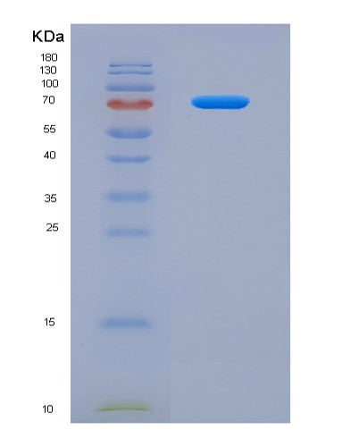 SDS-PAGE analysis of Human SMPD1 (Sphingomyelin Phosphodiesterase) - Recombinant Protein, CATHuman SMPD1 (Sphingomyelin Phosphodiesterase) - Recombinant Protein
