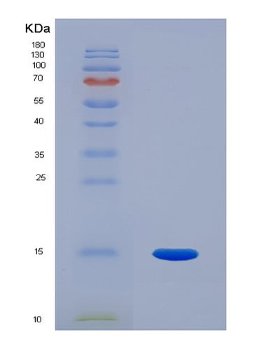 SDS-PAGE analysis of Human PGF (Placenta Growth Factor) - Recombinant Protein, CAT# BLT-07930P, showing >90% purity under 15% SDS-PAGE (Reduced)Human PGF (Placenta Growth Factor) - Recombinant Protein