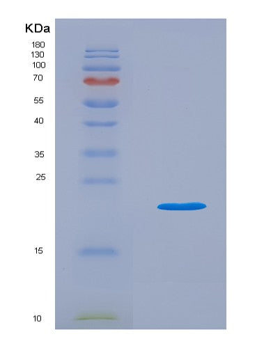 SDS-PAGE analysis of Mouse Il18 (Interleukin-18) - Recombinant Protein, CATMouse Il18 (Interleukin-18) - Recombinant Protein