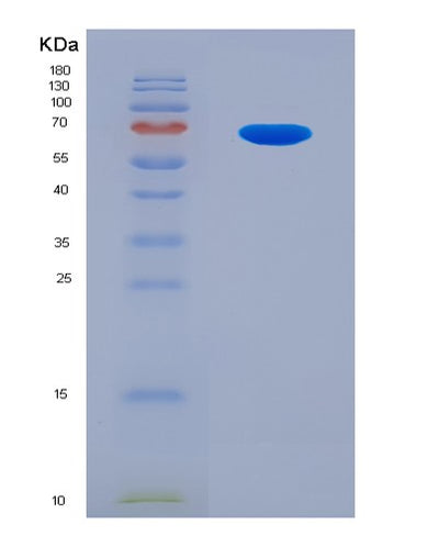 SDS-PAGE analysis of Human RSPO3 (R-Spondin-3) - Recombinant Protein, CAT# BLT-04218P, showing >90% purity under 15% SDS-PAGE (Reduced)Human RSPO3 (R-Spondin-3) - Recombinant Protein