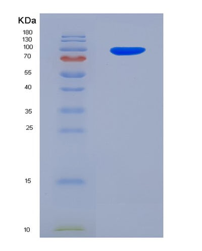 SDS-PAGE analysis of Human GFRA1 (Gdnf Family Receptor Alpha-1) - Recombinant Protein, CAT# BLT-07060P, showing >95% purity under 15% SDS-PAGE (Reduced)Human GFRA1 (Gdnf Family Receptor Alpha-1) - Recombinant Protein