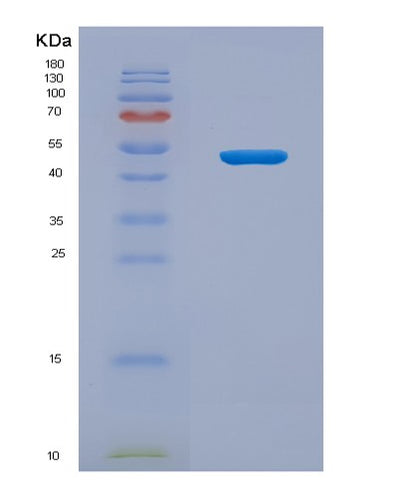 SDS-PAGE analysis of Mouse Lbp (Lipopolysaccharide-Binding Protein) - Recombinant Protein, CAT# BLT-07932P, showing >90% purity under 15% SDS-PAGE (Reduced)Mouse Lbp (Lipopolysaccharide-Binding Protein) - Recombinant Protein