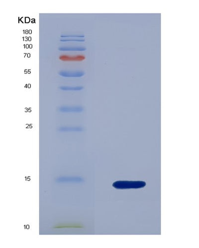 SDS-PAGE analysis of Human NR3C1 (Glucocorticoid Receptor) - Recombinant Protein, CAT# BLT-07933P, showing >90% purity under 15% SDS-PAGE (Reduced)Human NR3C1 (Glucocorticoid Receptor) - Recombinant Protein