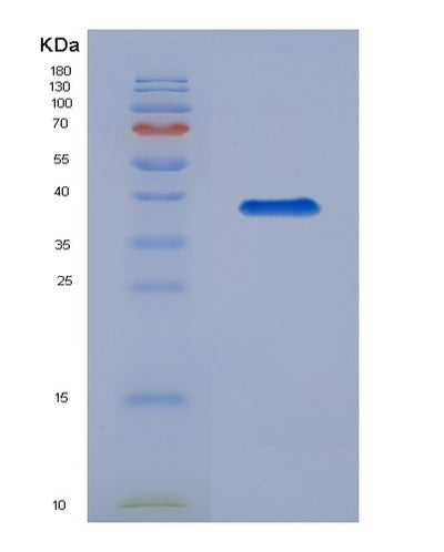 SDS-PAGE analysis of Mouse Mmp8 (Neutrophil Collagenase) - Recombinant Protein, CAT# BLT-07936P, showing >90% purity under 15% SDS-PAGE (Reduced)Mouse Mmp8 (Neutrophil Collagenase) - Recombinant Protein