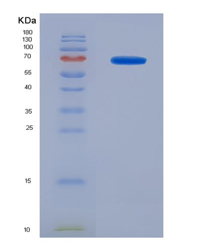SDS-PAGE analysis of Mouse Il15ra (Interleukin-15 Receptor Subunit Alpha) - Recombinant Protein, CAT# BLT-07938P, showing >90% purity under 15% SDS-PAGE (Reduced)Mouse Il15ra (Interleukin-15 Receptor Subunit Alpha) - Recombinant Protein