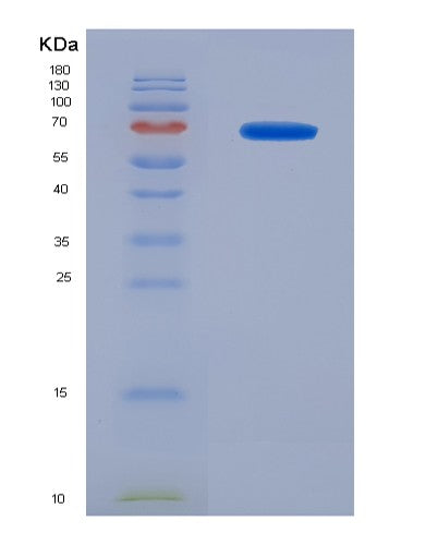SDS-PAGE analysis of Mouse Il15ra (Interleukin-15 Receptor Subunit Alpha) - Recombinant Protein, CATMouse Il15ra (Interleukin-15 Receptor Subunit Alpha) - Recombinant Protein