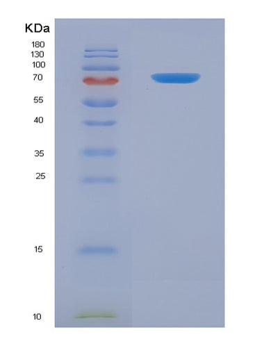 SDS-PAGE analysis of Mouse Gas6 (Growth Arrest-Specific Protein 6) - Recombinant Protein, CAT# BLT-07939P, showing >90% purity under 15% SDS-PAGE (Reduced)Mouse Gas6 (Growth Arrest-Specific Protein 6) - Recombinant Protein