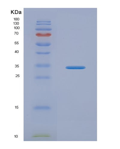 SDS-PAGE analysis of Human KLK2 (Kallikrein-2) - Recombinant Protein, CAT# BLT-03678P, showing >90% purity under 15% SDS-PAGE (Reduced)Human KLK2 (Kallikrein-2) - Recombinant Protein