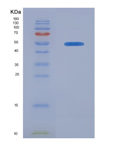 SDS-PAGE analysis of Human BMPR1A (Bone Morphogenetic Protein Receptor Type-1A) - Recombinant Protein, CAT# BLT-03503P, showing >90% purity under 15% SDS-PAGE (Reduced)Human BMPR1A (Bone Morphogenetic Protein Receptor Type-1A) - Recombinant Protein