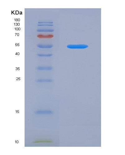SDS-PAGE analysis of Human TNFRSF14 (Tumor Necrosis Factor Receptor Superfamily Member 14) - Recombinant Protein, CATHuman TNFRSF14 (Tumor Necrosis Factor Receptor Superfamily Member 14) - Recombinant Protein