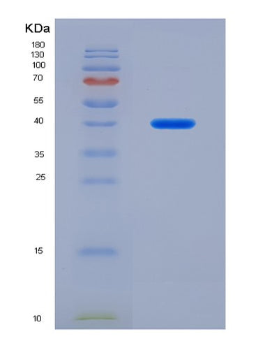 SDS-PAGE analysis of Human IL21R (Interleukin-21 Receptor) - Recombinant Protein, CAT# BLT-07940P, showing >90% purity under 15% SDS-PAGE (Reduced)Human IL21R (Interleukin-21 Receptor) - Recombinant Protein