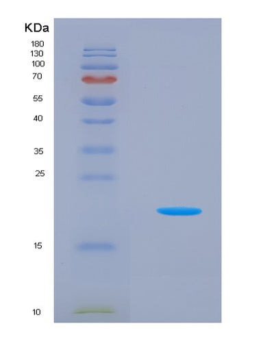 SDS-PAGE analysis of Human PLA2G2A (Phospholipase A2, Membrane Associated) - Recombinant Protein, CAT# BLT-07941P, showing >90% purity under 15% SDS-PAGE (Reduced)Human PLA2G2A (Phospholipase A2, Membrane Associated) - Recombinant Protein