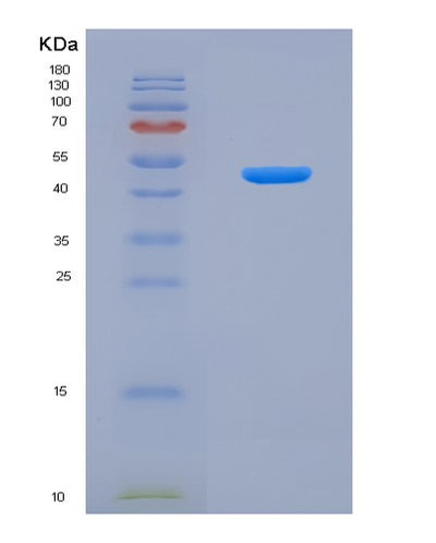 SDS-PAGE analysis of Human CASP9 (Caspase-9) - Recombinant Protein, CAT# BLT-07944P, showing >90% purity under 15% SDS-PAGE (Reduced)Human CASP9 (Caspase-9) - Recombinant Protein