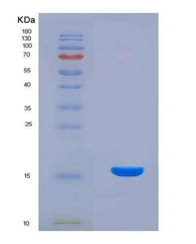 SDS-PAGE analysis of Human DGAT2 (Diacylglycerol O-Acyltransferase 2) - Recombinant Protein, CAT# BLT-07945P, showing >90% purity under 15% SDS-PAGE (Reduced)Human DGAT2 (Diacylglycerol O-Acyltransferase 2) - Recombinant Protein