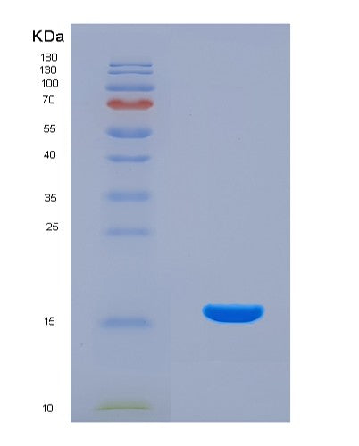 SDS-PAGE analysis of Human DGAT2 (Diacylglycerol O-Acyltransferase 2) - Recombinant Protein, CATHuman DGAT2 (Diacylglycerol O-Acyltransferase 2) - Recombinant Protein