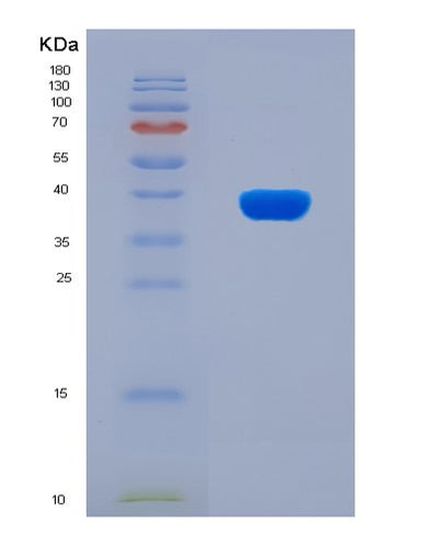 SDS-PAGE analysis of Mouse Ucn (Urocortin) - Recombinant Protein, CAT# BLT-07948P, showing >90% purity under 15% SDS-PAGE (Reduced)Mouse Ucn (Urocortin) - Recombinant Protein