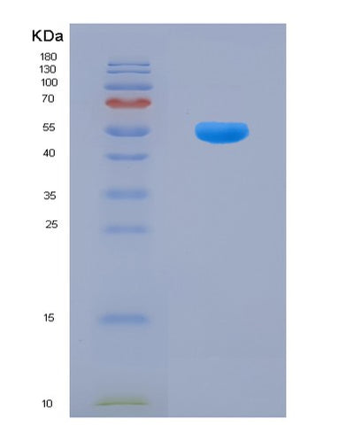 SDS-PAGE analysis of Mouse Flt3lg (Fms-Related Tyrosine Kinase 3 Ligand) - Recombinant Protein, CAT# BLT-07951P, showing >90% purity under 15% SDS-PAGE (Reduced)Mouse Flt3lg (Fms-Related Tyrosine Kinase 3 Ligand) - Recombinant Protein
