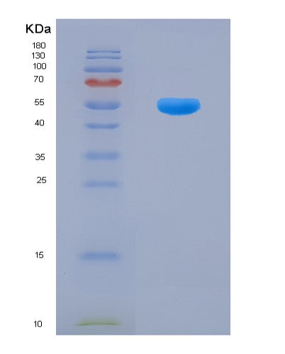 SDS-PAGE analysis of Mouse Flt3lg (Fms-Related Tyrosine Kinase 3 Ligand) - Recombinant Protein, CATMouse Flt3lg (Fms-Related Tyrosine Kinase 3 Ligand) - Recombinant Protein