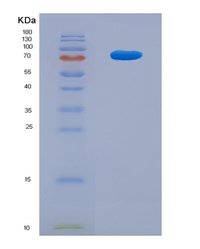 SDS-PAGE analysis of Mouse Tumor Necrosis Factor Ligand Superfamily, Member 13 (TNFSF13) - Recombinant Protein, CAT# BLT-07952P, showing >90% purity under 15% SDS-PAGE (Reduced)Mouse Tumor Necrosis Factor Ligand Superfamily, Member 13 (TNFSF13) - Recombinant Protein