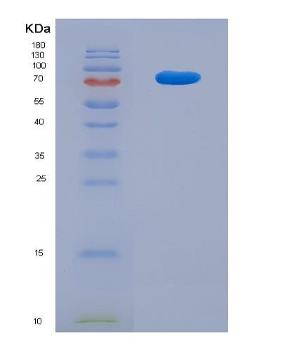 SDS-PAGE analysis of Mouse Tumor Necrosis Factor Ligand Superfamily, Member 13 (TNFSF13) - Recombinant Protein, CATMouse Tumor Necrosis Factor Ligand Superfamily, Member 13 (TNFSF13) - Recombinant Protein