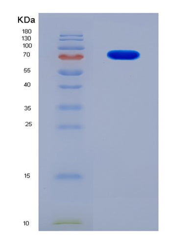 SDS-PAGE analysis of Mouse Hgf (Hepatocyte Growth Factor) - Recombinant Protein, CAT# BLT-07954P, showing >90% purity under 15% SDS-PAGE (Reduced)Mouse Hgf (Hepatocyte Growth Factor) - Recombinant Protein
