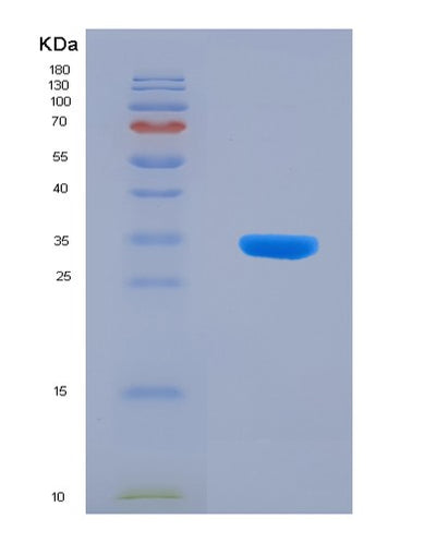 SDS-PAGE analysis of Human IGFBP5 (Insulin-Like Growth Factor-Binding Protein 5) - Recombinant Protein, CAT# BLT-07955P, showing >90% purity under 15% SDS-PAGE (Reduced)Human IGFBP5 (Insulin-Like Growth Factor-Binding Protein 5) - Recombinant Protein