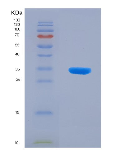 SDS-PAGE analysis of Human IGFBP5 (Insulin-Like Growth Factor-Binding Protein 5) - Recombinant Protein, CATHuman IGFBP5 (Insulin-Like Growth Factor-Binding Protein 5) - Recombinant Protein