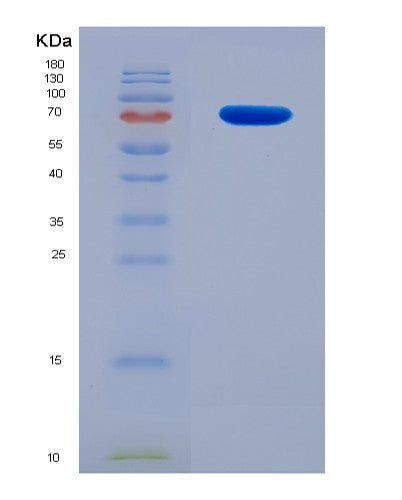 SDS-PAGE analysis of Human GRIN2B (Glutamate Receptor Ionotropic, Nmda 2B) - Recombinant Protein, CATHuman GRIN2B (Glutamate Receptor Ionotropic, Nmda 2B) - Recombinant Protein