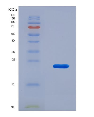 SDS-PAGE analysis of Human ITGA2B (Integrin Alpha-Iib) - Recombinant Protein, CAT# BLT-07958P, showing >90% purity under 15% SDS-PAGE (Reduced)Human ITGA2B (Integrin Alpha-Iib) - Recombinant Protein