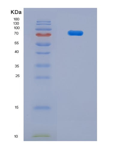 SDS-PAGE analysis of Mouse Hsp90b1 (Endoplasmin) - Recombinant Protein, CAT# BLT-07960P, showing >90% purity under 15% SDS-PAGE (Reduced)Mouse Hsp90b1 (Endoplasmin) - Recombinant Protein