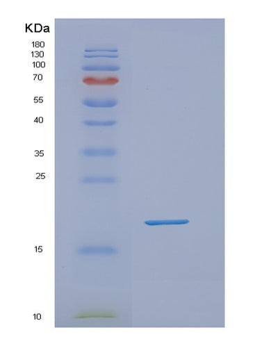 SDS-PAGE analysis of Mouse Dpp4 (Dipeptidyl Peptidase 4) - Recombinant Protein, CAT# BLT-07959P, showing >90% purity under 15% SDS-PAGE (Reduced)Mouse Dpp4 (Dipeptidyl Peptidase 4) - Recombinant Protein