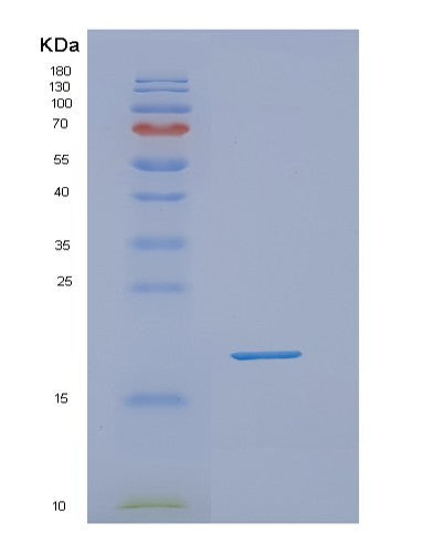 SDS-PAGE analysis of Mouse Dpp4 (Dipeptidyl Peptidase 4) - Recombinant Protein, CATMouse Dpp4 (Dipeptidyl Peptidase 4) - Recombinant Protein