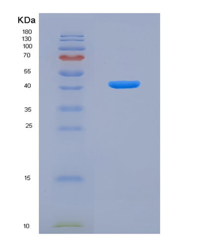 SDS-PAGE analysis of Mouse Ctsb (Cathepsin B) - Recombinant Protein, CAT# BLT-04925P, showing >85% purity under 15% SDS-PAGE (Reduced)Mouse Ctsb (Cathepsin B) - Recombinant Protein