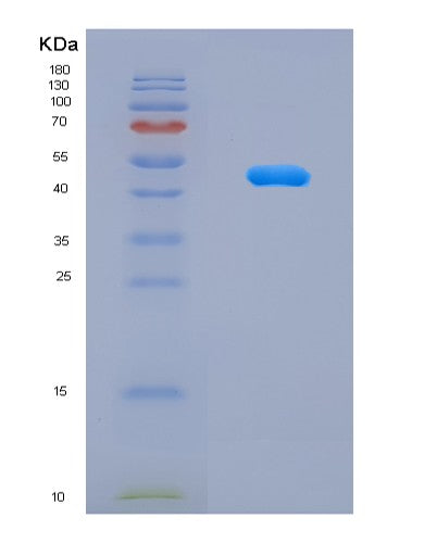 SDS-PAGE analysis of Human NCR3LG1 (Natural Cytotoxicity Triggering Receptor 3 Ligand 1) - Recombinant Protein, CATHuman NCR3LG1 (Natural Cytotoxicity Triggering Receptor 3 Ligand 1) - Recombinant Protein