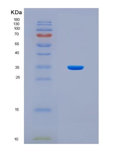 SDS-PAGE analysis of Human IL-17A/F Heterodimer - Recombinant Protein, CAT# BLT-07961P, showing >90% purity under 15% SDS-PAGE (Reduced)Human IL-17A/F Heterodimer - Recombinant Protein