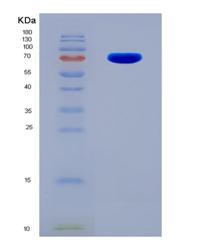 SDS-PAGE analysis of Human CRTAM (Cytotoxic And Regulatory T-Cell Molecule) - Recombinant Protein, CAT# BLT-03663P, showing >95% purity under 15% SDS-PAGE (Reduced)Human CRTAM (Cytotoxic And Regulatory T-Cell Molecule) - Recombinant Protein