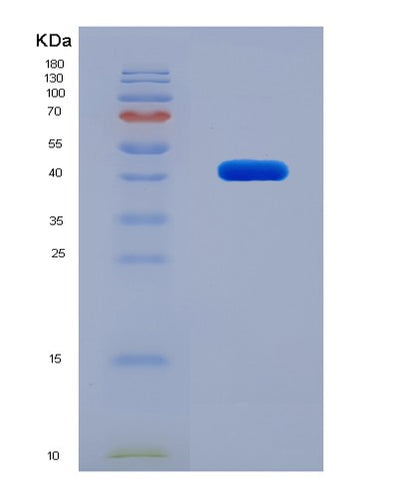 SDS-PAGE analysis of Human DUSP9 (Dual Specificity Protein Phosphatase 9) - Recombinant Protein, CAT# BLT-07963P, showing >90% purity under 15% SDS-PAGE (Reduced)Human DUSP9 (Dual Specificity Protein Phosphatase 9) - Recombinant Protein