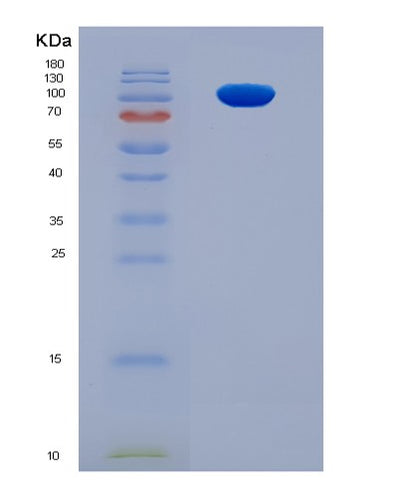 SDS-PAGE analysis of Mouse Erbb3 (Receptor Tyrosine-Protein Kinase Erbb-3) - Recombinant Protein, CAT# BLT-06428P, showing >95% purity under 15% SDS-PAGE (Reduced)Mouse Erbb3 (Receptor Tyrosine-Protein Kinase Erbb-3) - Recombinant Protein