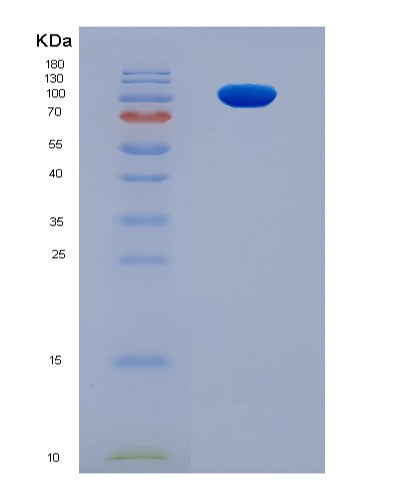 SDS-PAGE analysis of Mouse Erbb3 (Receptor Tyrosine-Protein Kinase Erbb-3) - Recombinant Protein, CATMouse Erbb3 (Receptor Tyrosine-Protein Kinase Erbb-3) - Recombinant Protein