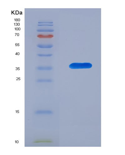 SDS-PAGE analysis of Human CD52 (Campath-1 Antigen) - Recombinant Protein, CAT# BLT-07964P, showing >90% purity under 15% SDS-PAGE (Reduced)Human CD52 (Campath-1 Antigen) - Recombinant Protein
