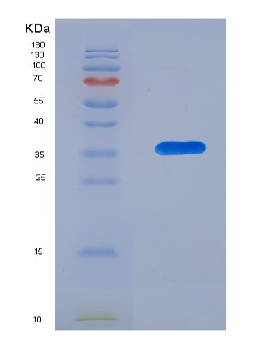 SDS-PAGE analysis of Human CD52 (Campath-1 Antigen) - Recombinant Protein, CATHuman CD52 (Campath-1 Antigen) - Recombinant Protein