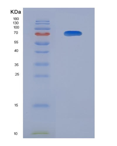 SDS-PAGE analysis of Human TIMD4 (T-Cell Immunoglobulin And Mucin Domain-Containing Protein 4) - Recombinant Protein, CAT# BLT-07965P, showing >90% purity under 15% SDS-PAGE (Reduced)Human TIMD4 (T-Cell Immunoglobulin And Mucin Domain-Containing Protein 4) - Recombinant Protein