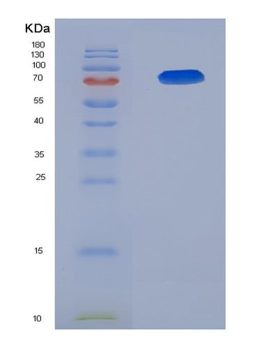 SDS-PAGE analysis of Human AMIGO2 (Amphoterin-Induced Protein 2) - Recombinant Protein, CAT# BLT-05786P, showing >85% purity under 15% SDS-PAGE (Reduced)Human AMIGO2 (Amphoterin-Induced Protein 2) - Recombinant Protein