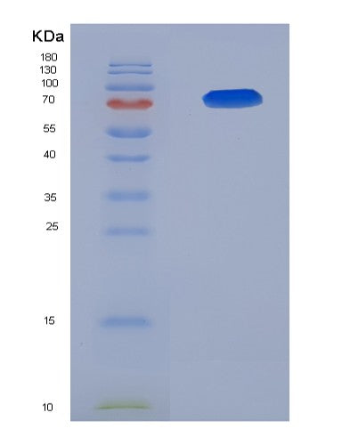 SDS-PAGE analysis of Human AMIGO2 (Amphoterin-Induced Protein 2) - Recombinant Protein, CATHuman AMIGO2 (Amphoterin-Induced Protein 2) - Recombinant Protein