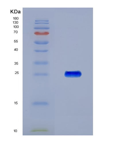 SDS-PAGE analysis of Human CDH2 (Cadherin-2) - Recombinant Protein, CAT# BLT-07966P, showing >90% purity under 15% SDS-PAGE (Reduced)Human CDH2 (Cadherin-2) - Recombinant Protein