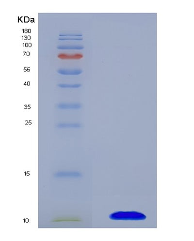 SDS-PAGE analysis of Human SLC22A12 (Solute Carrier Family 22 Member 12) - Recombinant Protein, CAT# BLT-07967P, showing >90% purity under 15% SDS-PAGE (Reduced)Human SLC22A12 (Solute Carrier Family 22 Member 12) - Recombinant Protein