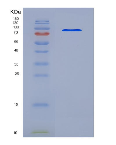 SDS-PAGE analysis of Mouse Icam1 (Intercellular Adhesion Molecule 1) - Recombinant Protein, CAT# BLT-05332P, showing >95% purity under 15% SDS-PAGE (Reduced)Mouse Icam1 (Intercellular Adhesion Molecule 1) - Recombinant Protein