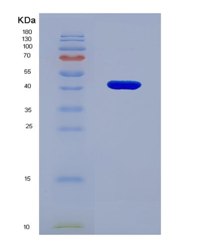 SDS-PAGE analysis of Human CA14 (Carbonic Anhydrase 14) - Recombinant Protein, CAT# BLT-05441P, showing >85% purity under 15% SDS-PAGE (Reduced)Human CA14 (Carbonic Anhydrase 14) - Recombinant Protein